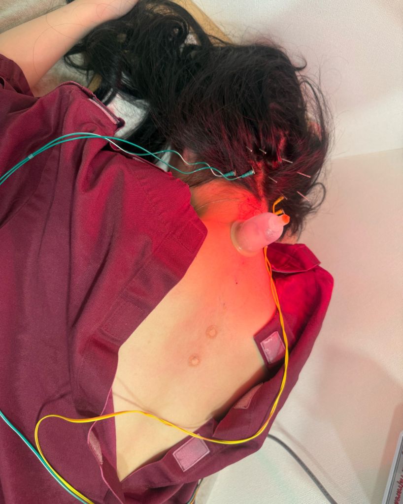 Chuna Manual Therapy